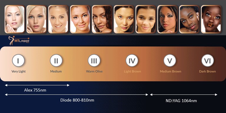 خرید لیزر دایود