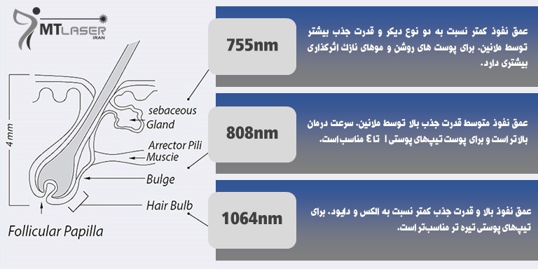 مقایسه دستگاه‌های لیزر مو