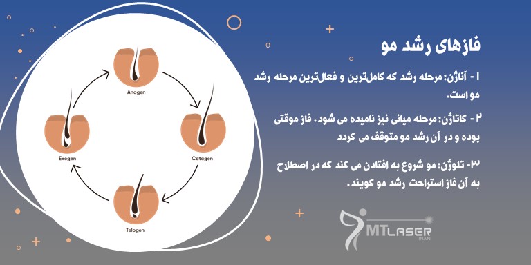خرید دستگاه لیزر مو