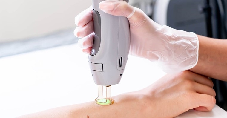 دوره آموزش اپراتور لیزر موهای زائد